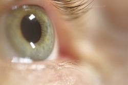 Cell Therapy Blindness
