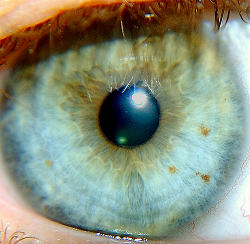 Eye Cancer