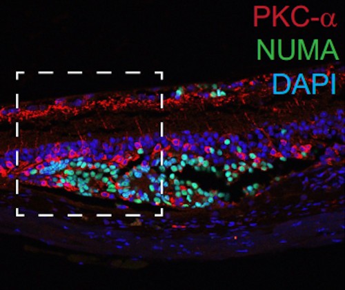 Stem Cell Study Shows Promise in Restoring Vision in Eye Diseases