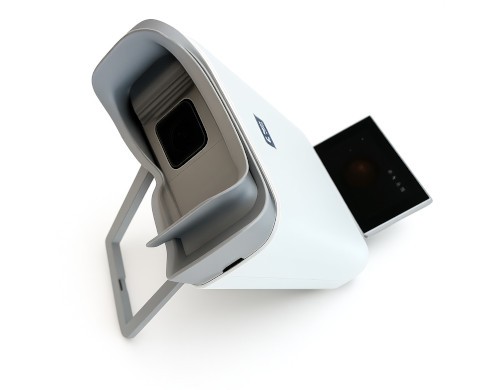 AI Eye Scan