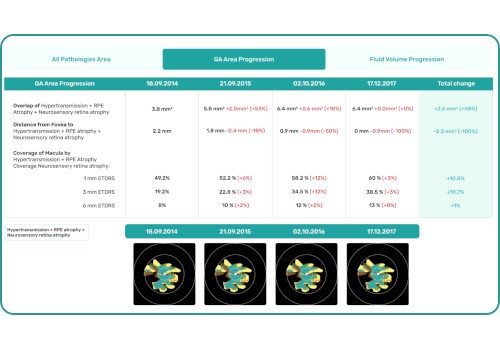 Altris - Fluids GS quantification