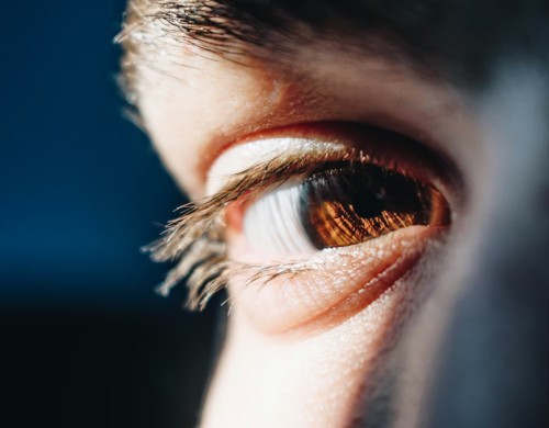 eye lid margin collarettes