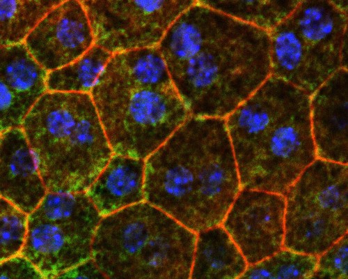 color-stained retinal epithelial cells from a mouse eye