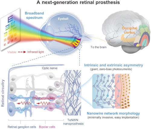 next generation retinal prosthesis