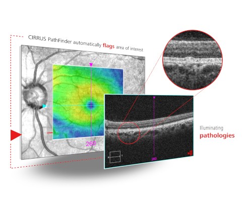 zeiss cirrus pathfinder keyvisual