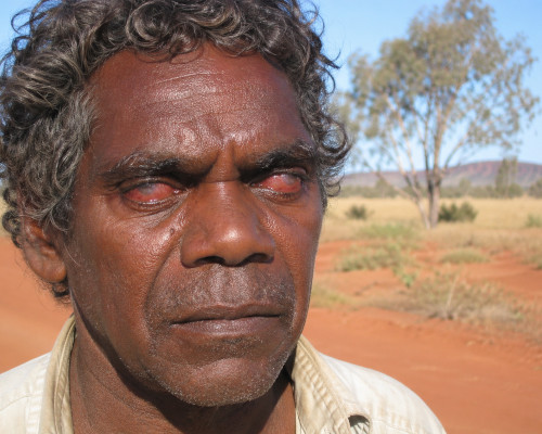 trachoma patient Australia