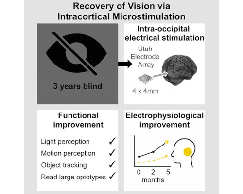 vision recovery cortical electrical stimulation